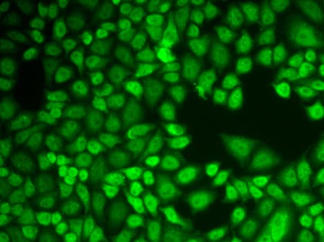 Polyclonal Rabbit anti-Human CTSD / Cathepsin D Antibody (IHC, IF, WB)