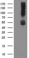 Monoclonal Mouse anti-Human SQSTM1 Antibody (clone OTI5A1, IHC, IF, WB)