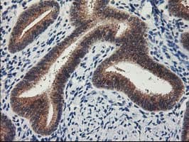 LPL / Lipoprotein Lipase Antibody (clone OTI3A10)