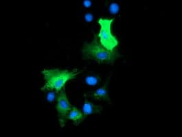 Monoclonal Mouse anti-Human HDAC6 Antibody (clone OTI1B3, IHC, IF, WB)