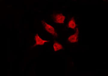 Polyclonal Rabbit anti-Human CHEK1 / CHK1 Antibody (phospho-Ser317, IHC, IF, WB)