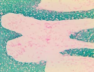 Cytokeratin 5+6+8+17+19 Antibody (clone MNF116)
