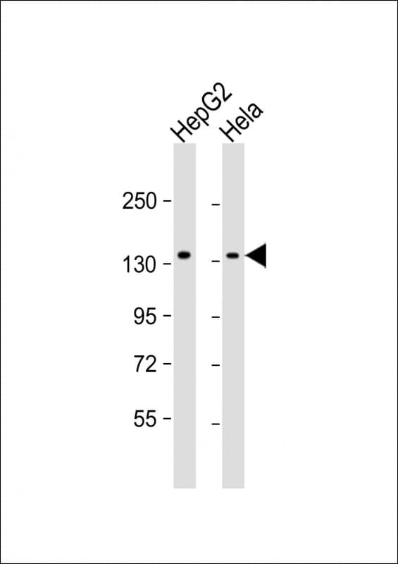 RBM6 / 3G2 Antibody (clone 1583CT111.17.7.37)