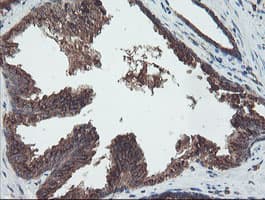 DPH2 Antibody (clone OTI4E7)