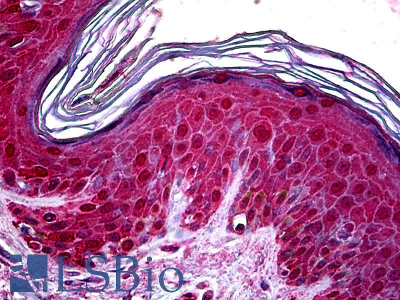 IHC-plus™ TSG101 Antibody (clone 5B7)