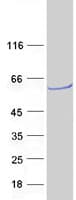 Human ATP6V1B2 Protein (Recombinant Myc-DDK (Flag))
