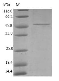 Human TIM23 Protein (Recombinant GST, N-terminus)
