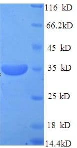 Mouse PITX3 Protein (Recombinant His)