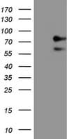 ALOX15 / 15-Lipoxygenase Antibody (clone 7H6, Carrier-free)