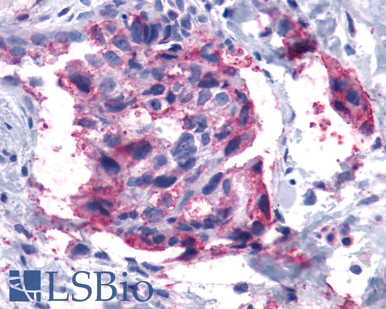 PathPlus™ LTB4R2 / BLT2 Antibody (Cytoplasmic Domain)