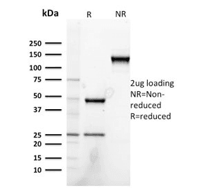 NRG1 / Heregulin / Neuregulin Antibody (clone NRG1/2752)