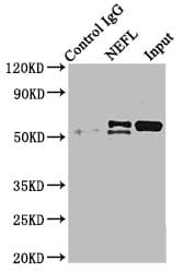 NF-L / NEFL Antibody (aa128-271)