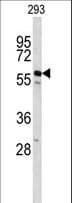 CDC14B Antibody (aa188-215)