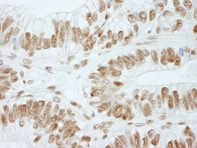 Polyclonal Rabbit anti-Human RBBP5 Antibody (aa500-C-term, IHC)