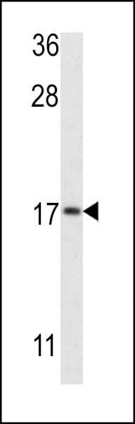 Polyclonal Rabbit anti-Human MAP1LC3B / LC3B Antibody (aa74-106, IHC, WB)