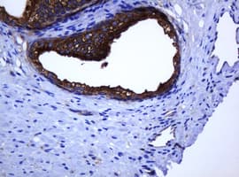 CATIP / C2orf62 Antibody (clone OTI2D9)