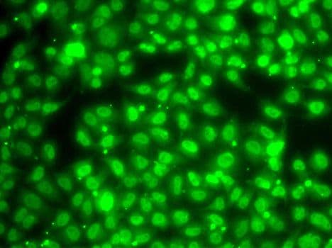ZNF264 Antibody