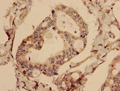 Polyclonal Rabbit anti-Human CFAP61 / C20orf26 Antibody (IHC)