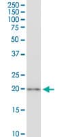 Monoclonal Mouse anti-Human CSRP3 Antibody (clone 6D2, IF, WB)