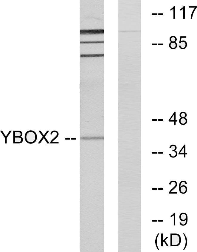 MSY2 / YBX2 Antibody