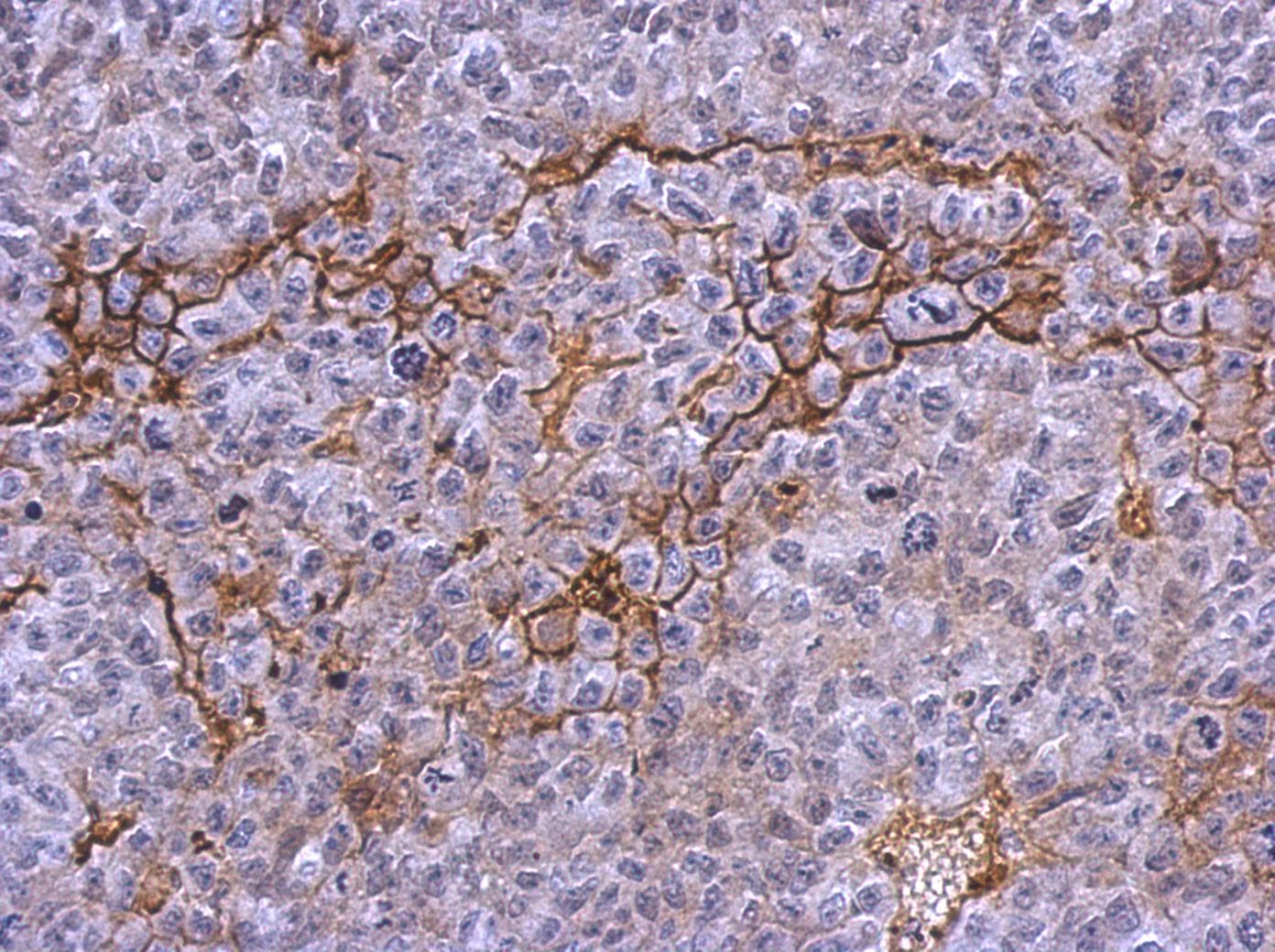 Polyclonal Rabbit anti-Human ITGA2B / CD41 Antibody (aa210-532, IHC, WB)