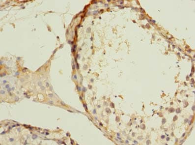 Polyclonal Rabbit anti-Human ZBTB43 Antibody (IHC)