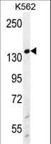 IHC-plus™ WRN Antibody (aa787-816)