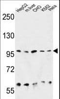 IHC-plus™ Polyclonal Rabbit anti-Human HSP90B1 / GP96 / GRP94 Antibody (aa16-43, IHC, IF, WB)