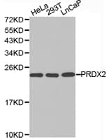 PRDX2 / Peroxiredoxin 2 Antibody