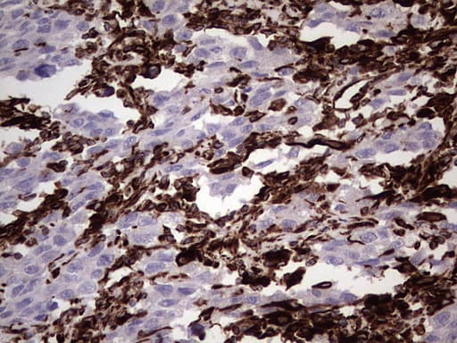 Vimentin Antibody (aa210-466, clone UMAB159)