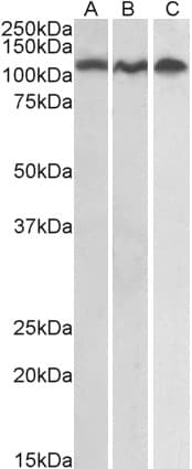 IHC-plus™ ADAM17 / TACE Antibody (C-Terminus)