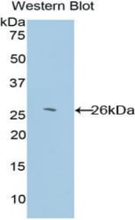 GSTK1 Antibody (aa20-214, PE)