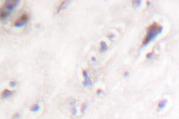 IAPP / Amylin Antibody (His28)