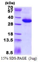 Human MRTO4 Protein (Recombinant His)