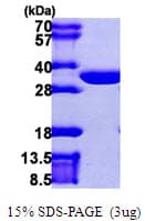 Human CLIC2 Protein (Recombinant His)