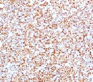 CCND1 / Cyclin D1 Antibody (clone BCLD1-1)