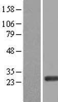 ERAS Protein (Over-Expression Lysate Myc-DDK (Flag))