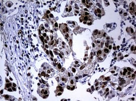 Monoclonal Mouse anti-Human PCNA Antibody (clone OTI1D11, IHC, WB)