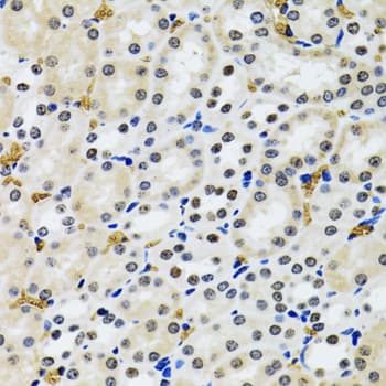 Polyclonal Rabbit anti-Human TP53BP1 / 53BP1 Antibody (IHC, IF, WB)