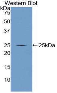 NUP160 Antibody (aa11-206, PE)