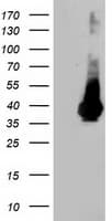 ARH / LDLRAP1 Antibody (clone OTI7E11)