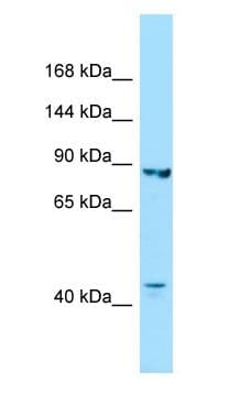Polyclonal Rabbit anti-Human IPO8 / Importin 8 Antibody (aa646-695, WB)