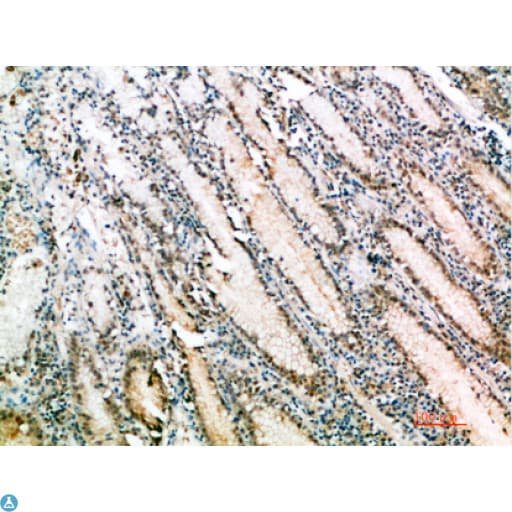 TFF1 / pS2 Antibody