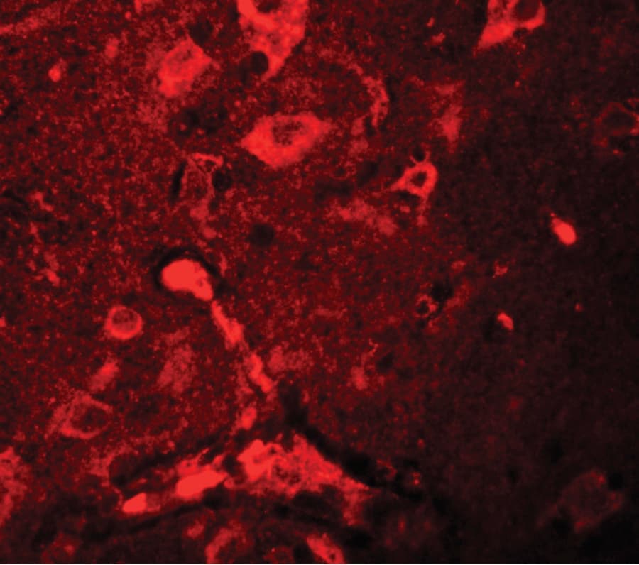 IHC-plus™ APBA2 Antibody
