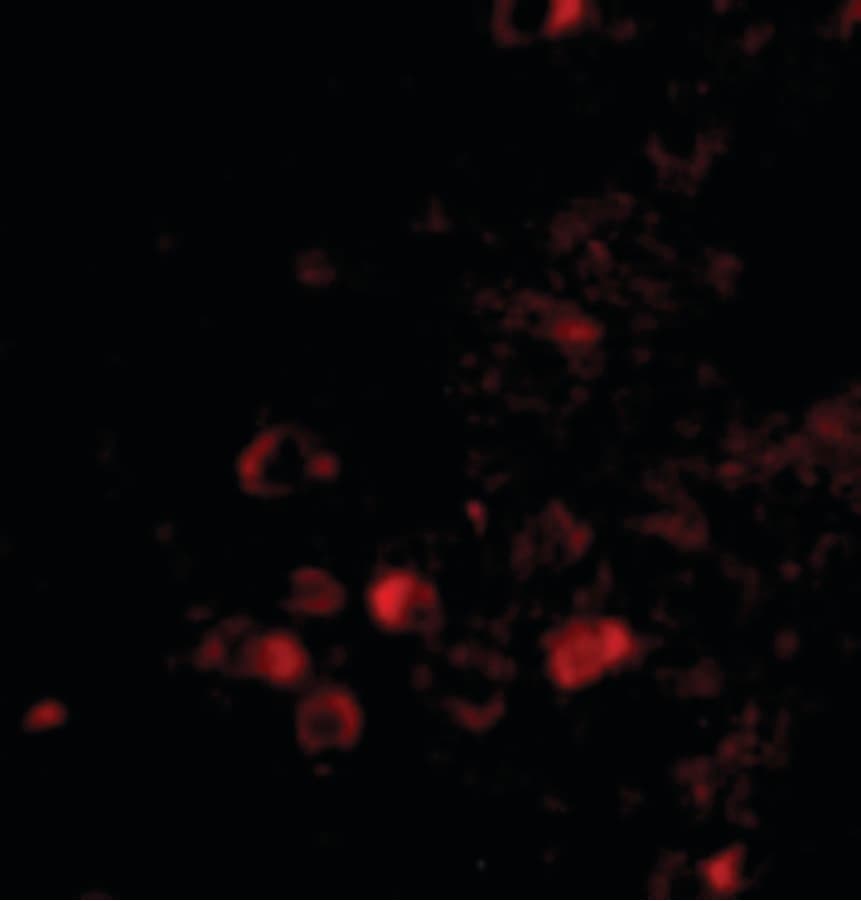 IHC-plus™ Polyclonal Rabbit anti-Human ELOVL6 Antibody (IHC, IF, WB)