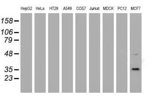 GRHPR / Glyoxylate Reductase Antibody (clone OTI9E6)
