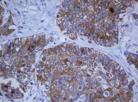 KRT20 / CK20 / Cytokeratin 20 Antibody (aa1-266, clone OTI4A2, Carrier-free)