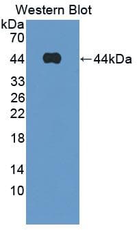 FABP4 / AP2 Antibody (aa2-132)