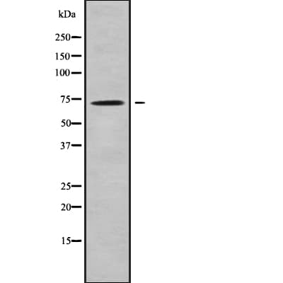 SLC25A13 / CITRIN Antibody