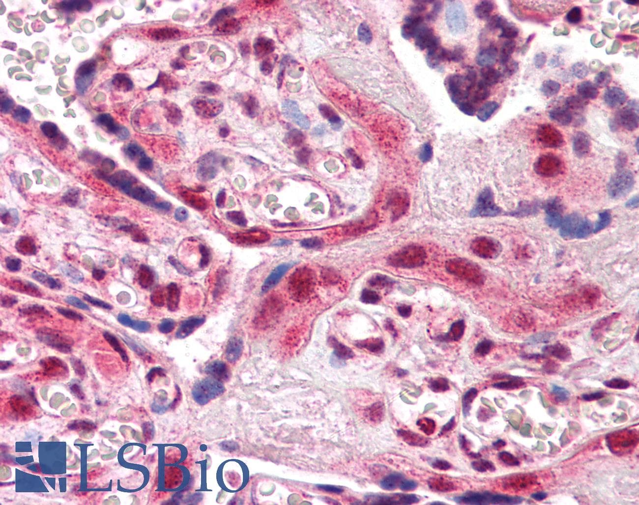 IHC-plus™ Polyclonal Goat anti-Human ARA9 / AIP Antibody (aa310-323, IHC, WB)